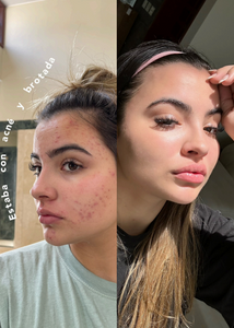 RENÖVA+ | Tu dosis Diaria de Juventud y Vitalidad